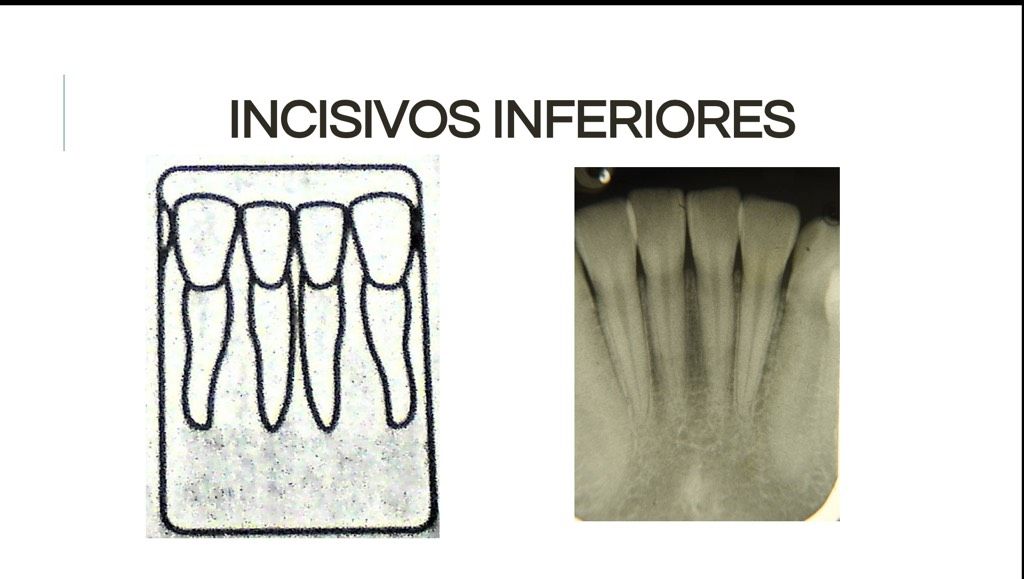 Áreas Prescritas