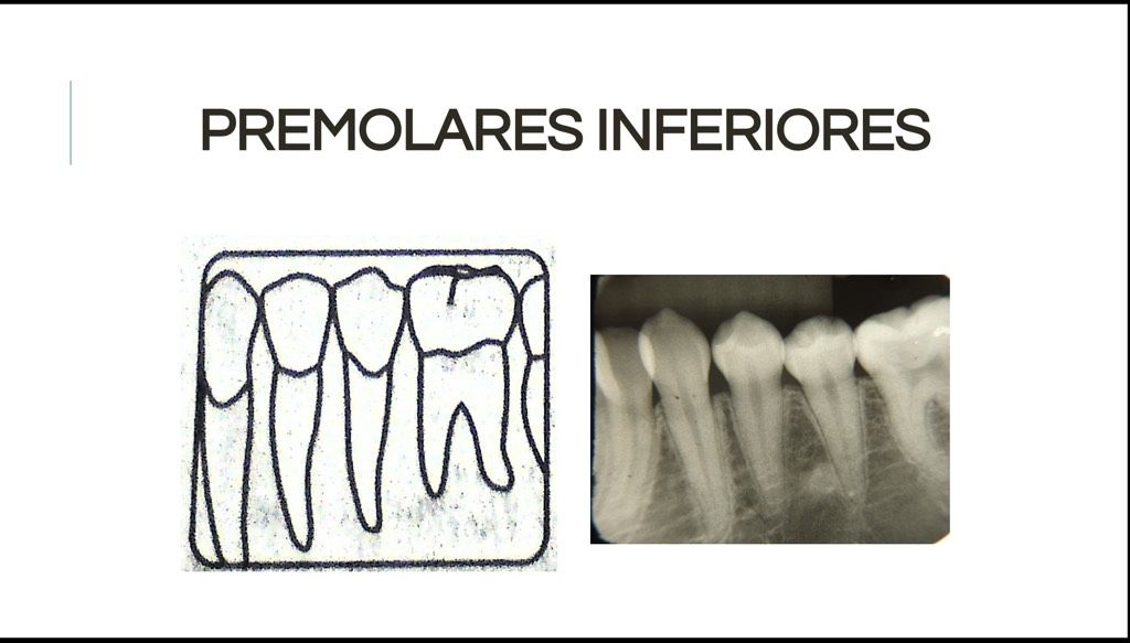 Áreas Prescritas