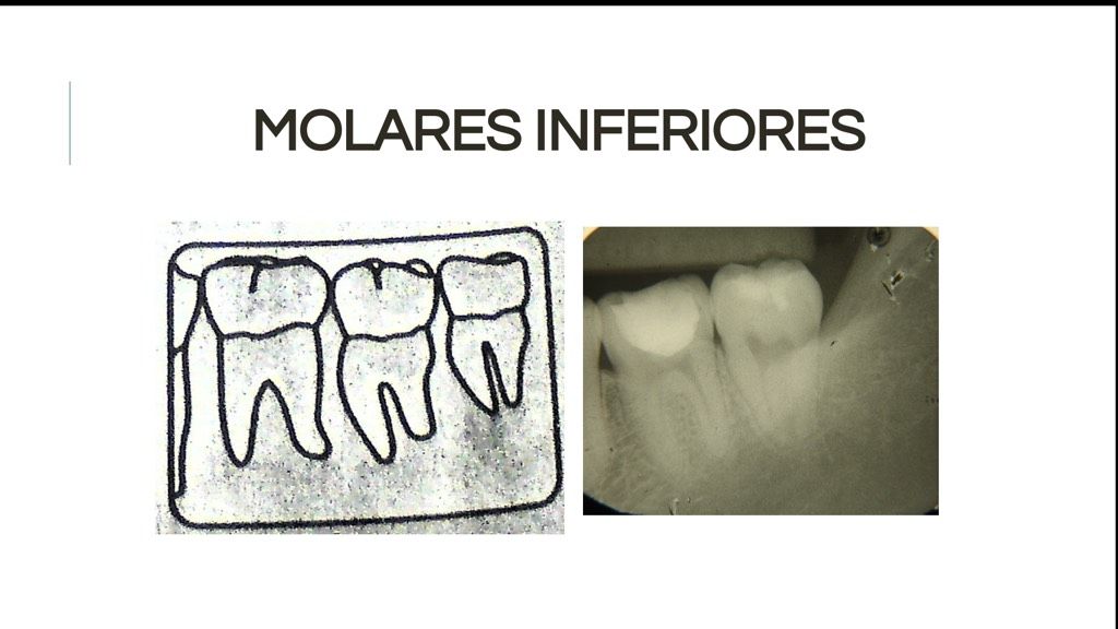 Áreas Prescritas