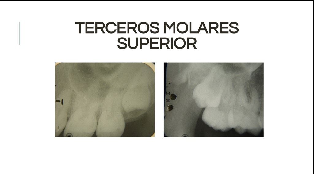 Áreas Prescritas