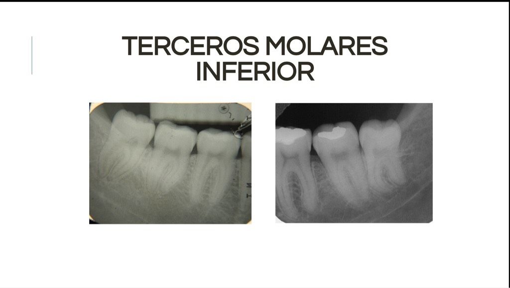 Áreas Prescritas