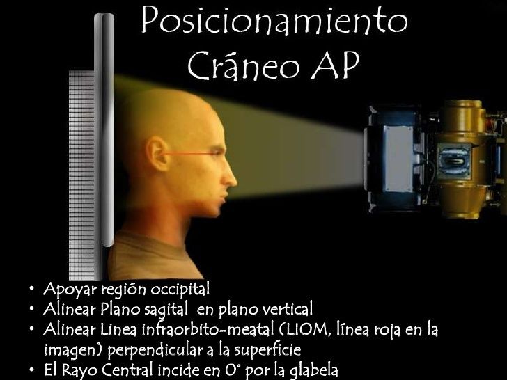 Técnicas Radiográficas extrabucales
