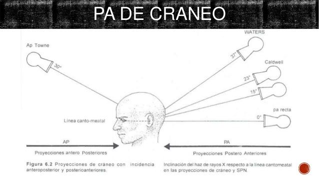 Técnicas Radiográficas extrabucales