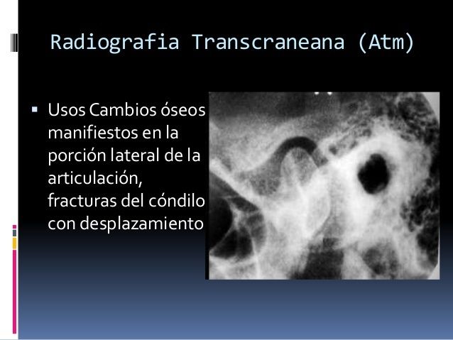 Técnicas Radiográficas extrabucales