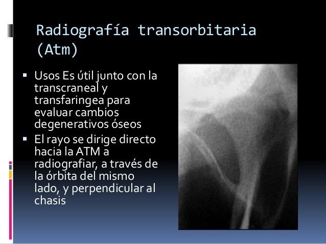 Técnicas Radiográficas extrabucales
