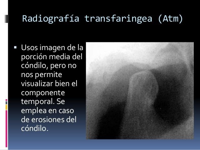 Técnicas Radiográficas extrabucales