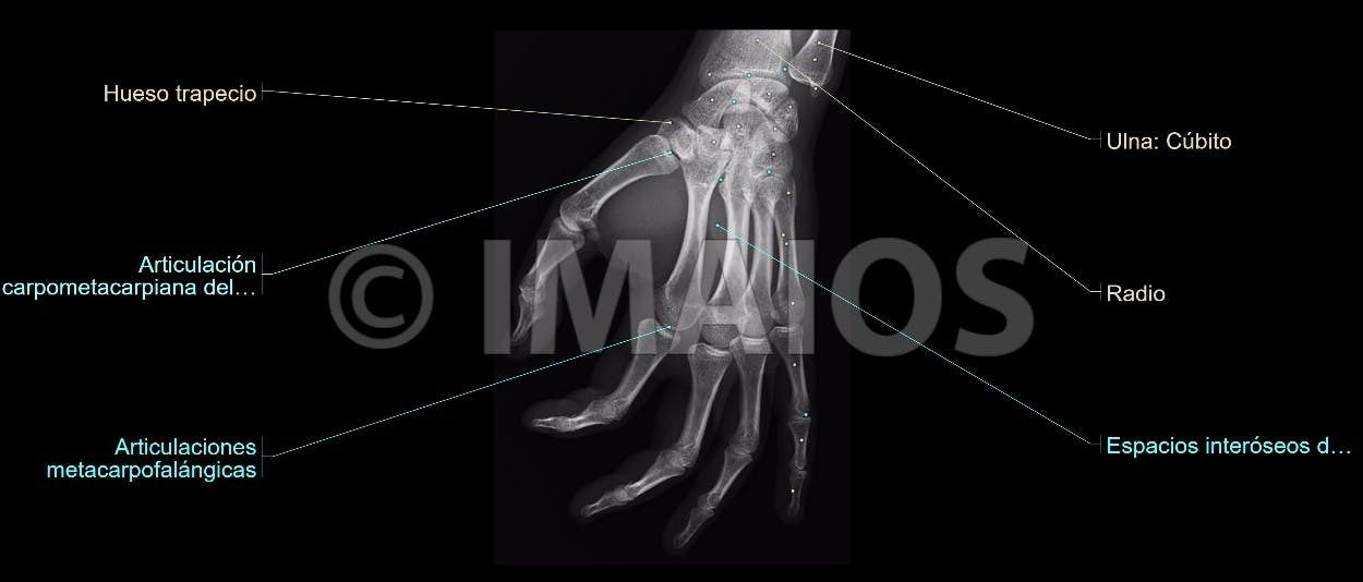 Anatomía Radiológica Ósea y Articular