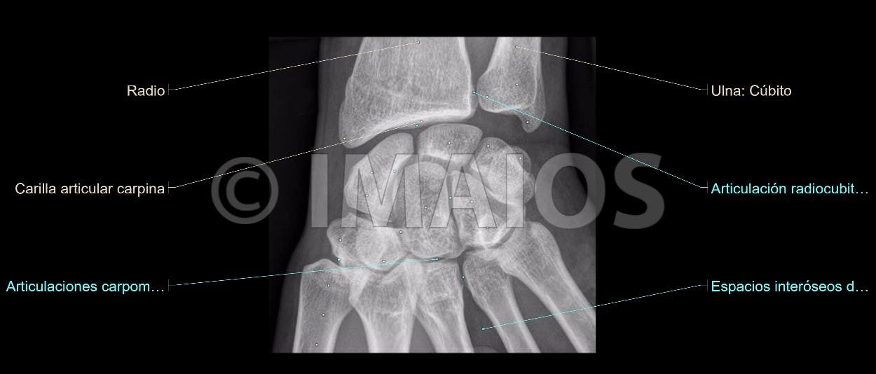 Anatomía Radiológica Ósea y Articular