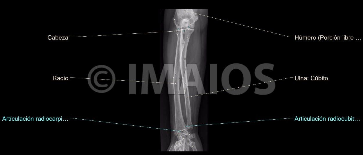 Anatomía Radiológica Ósea y Articular