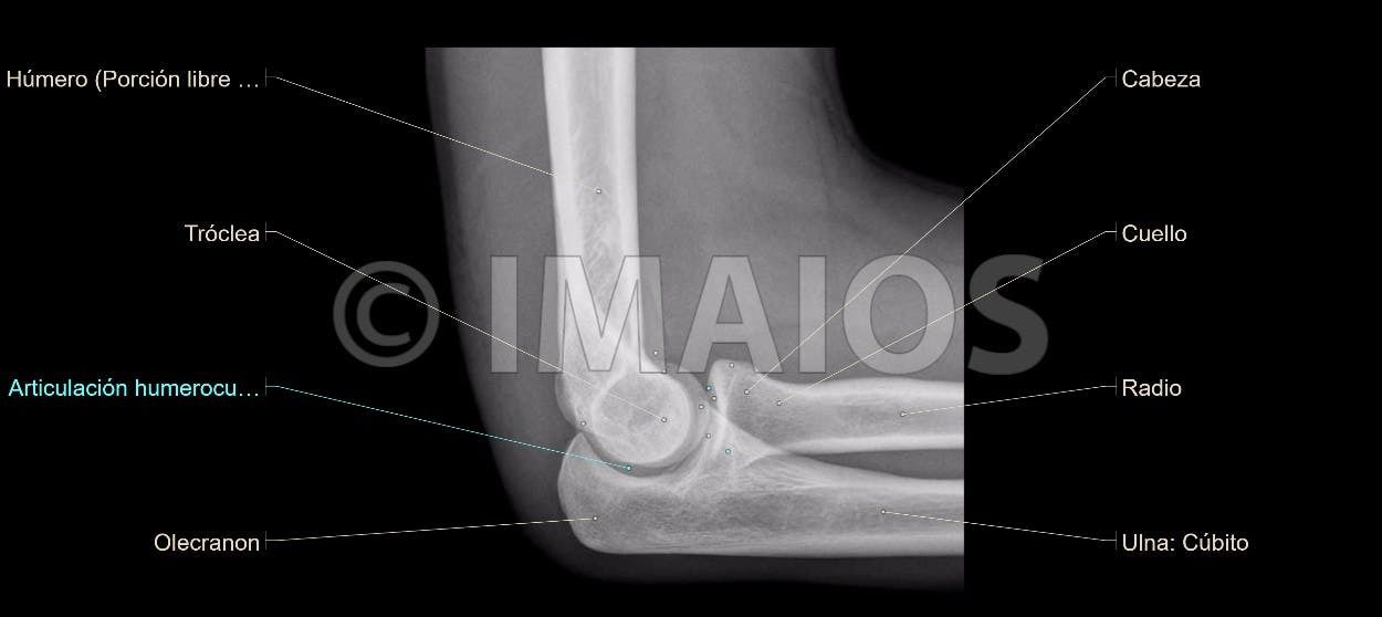 Anatomía Radiológica Ósea y Articular