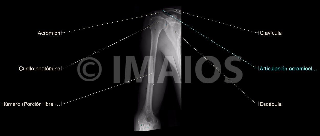Anatomía Radiológica Ósea y Articular