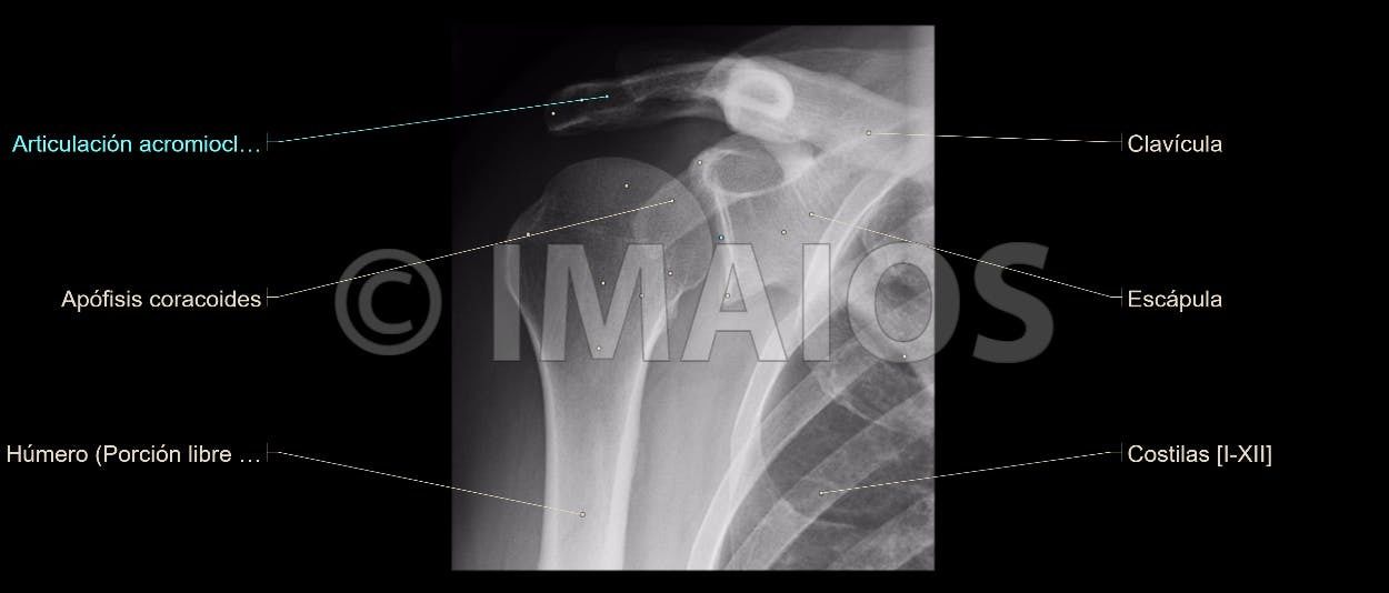 Anatomía Radiológica Ósea y Articular