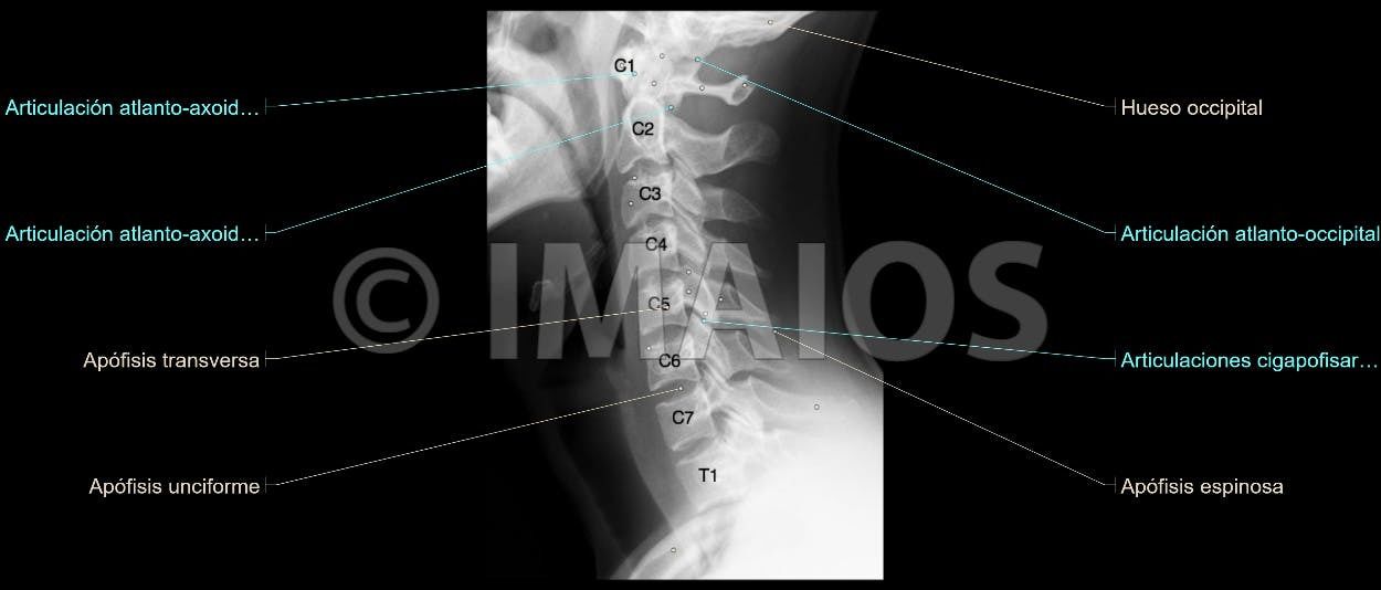 Anatomía Radiológica Ósea y Articular
