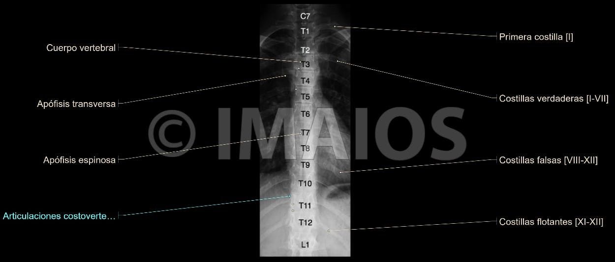 Anatomía Radiológica Ósea y Articular