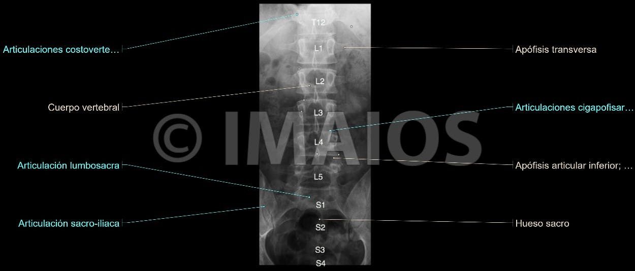 Anatomía Radiológica Ósea y Articular