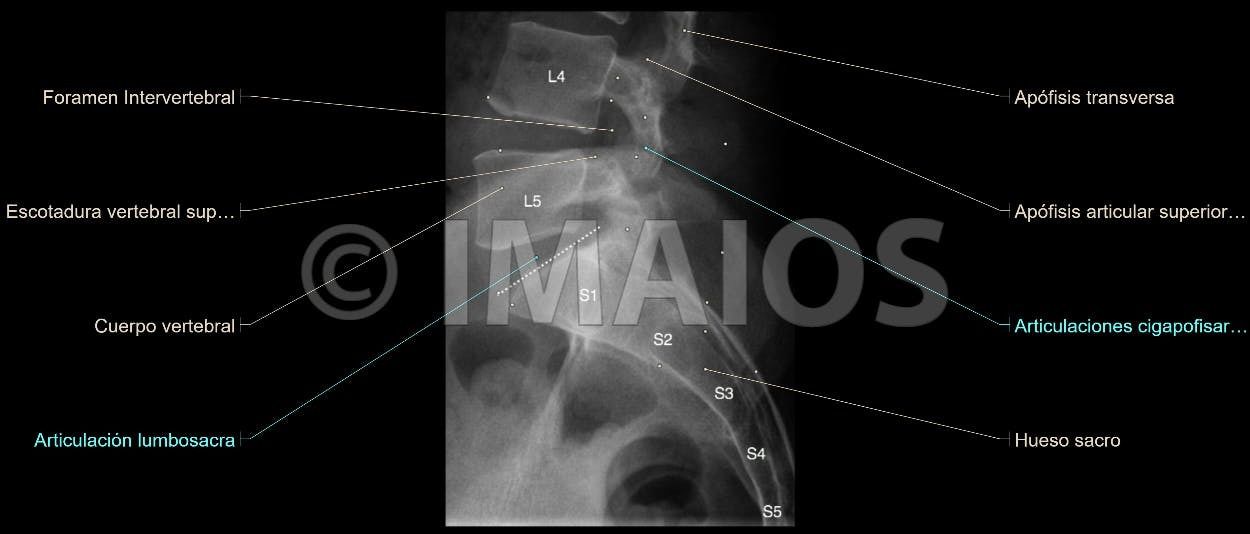 Anatomía Radiológica Ósea y Articular