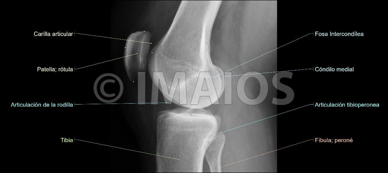 Anatomía Radiológica Ósea y Articular