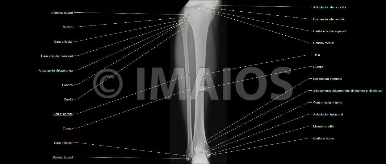 Anatomía Radiológica Ósea y Articular