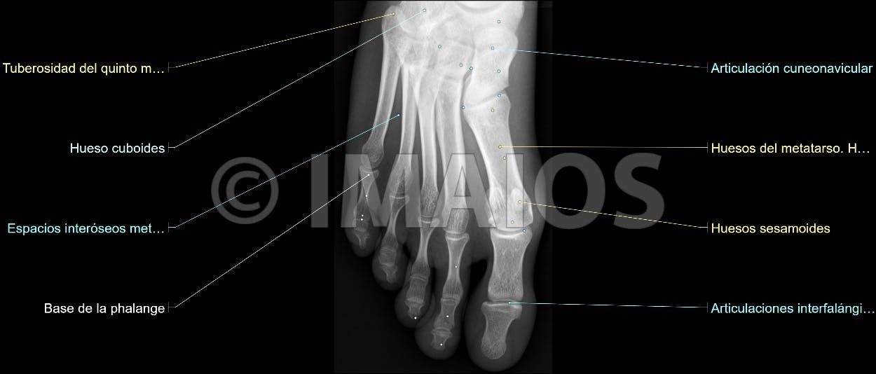 Anatomía Radiológica Ósea y Articular