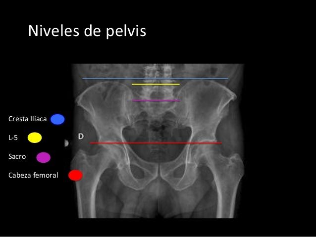 Anatomía Radiológica Ósea y Articular