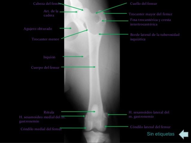 Anatomía Radiológica Ósea y Articular