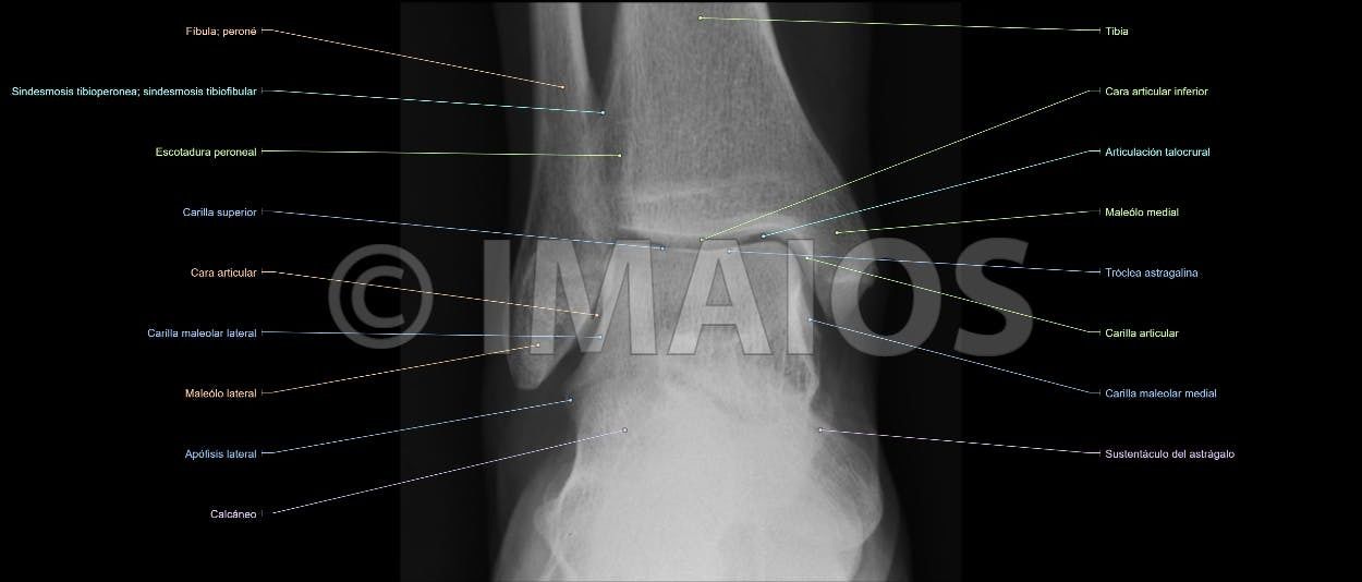 Anatomía Radiológica Ósea y Articular