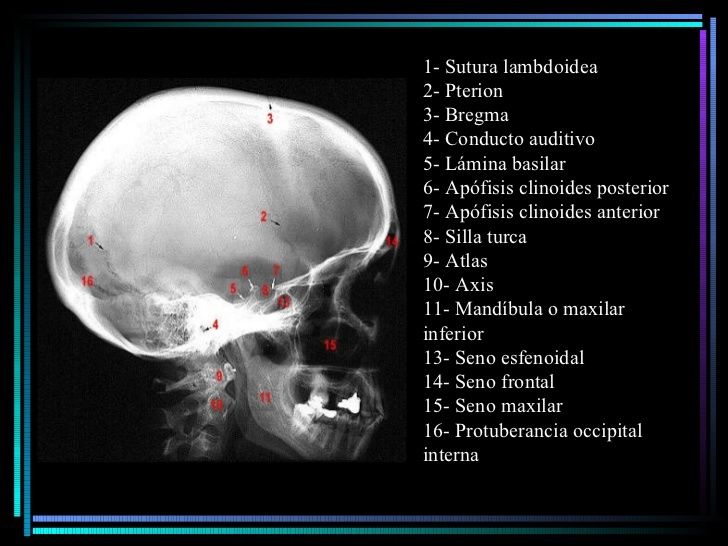 Anatomía Radiológica Ósea y Articular