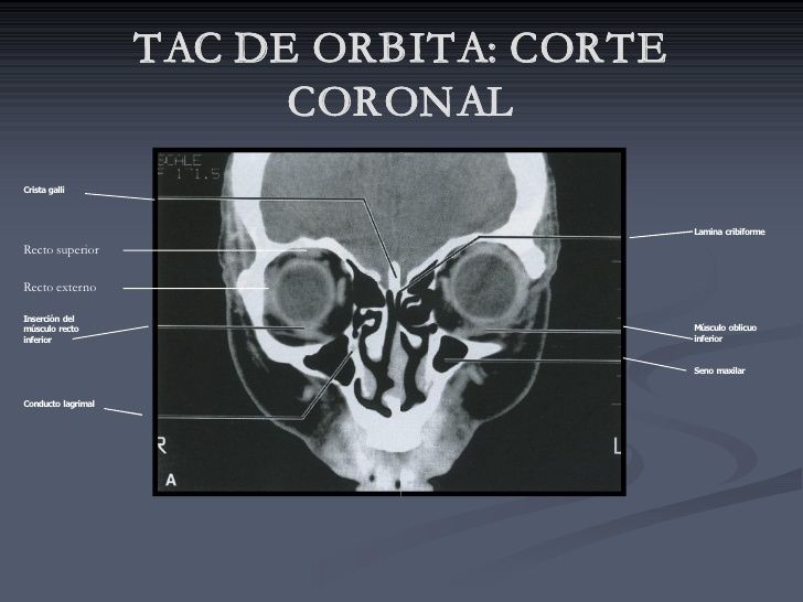 Anatomía Radiológica Ósea y Articular