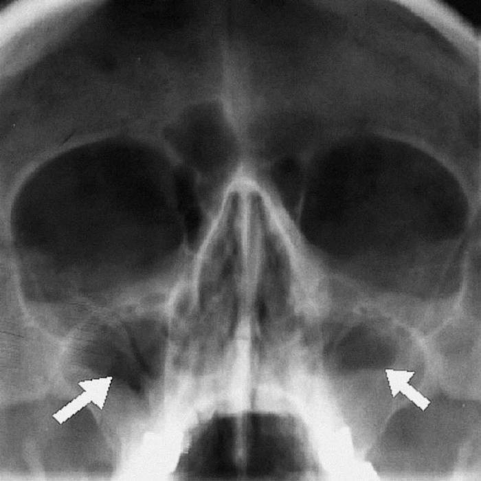 Anatomía Radiológica Ósea y Articular