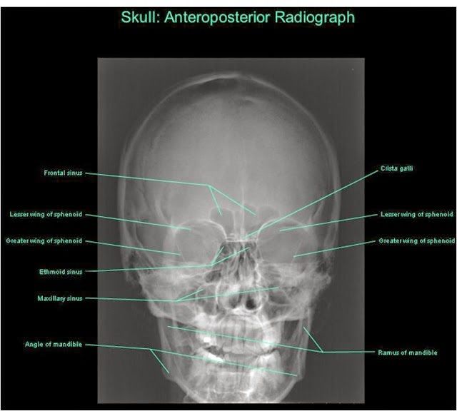 Anatomía Radiológica Ósea y Articular