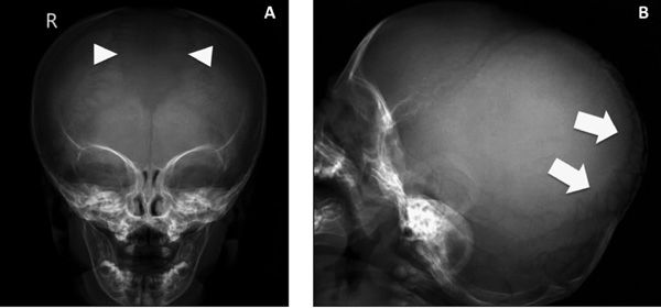 Anatomía Radiológica Ósea y Articular