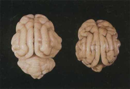 Hipoplasia