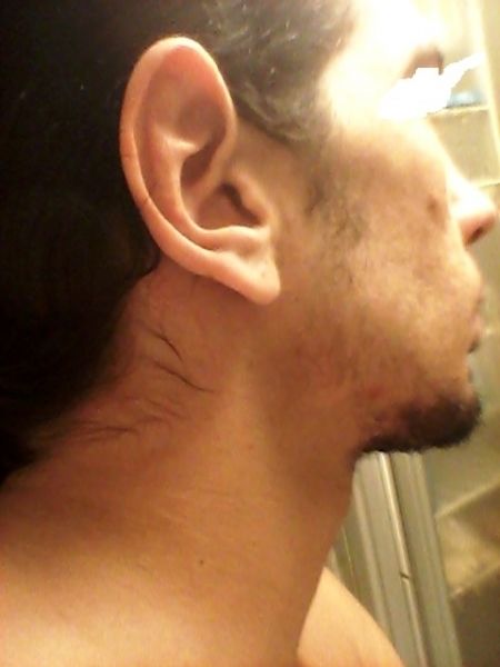 Macrotia Pabellon auricular largo *Sx. X frágil *Leprechaum