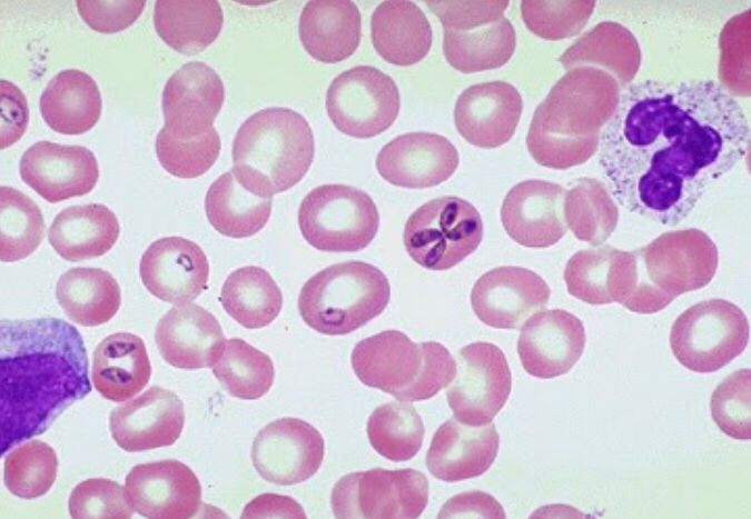 Babebiosis •es una de los claros ejemplos de cómo el cambio climático puede incrementar el riesgo de l salud humana •transmitida por garr...