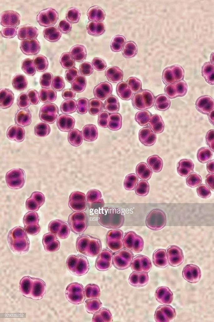 Metabolismo de Neisseria meningitidis