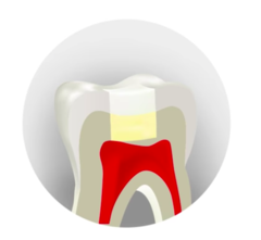 BIODENTINE Y THERACAL