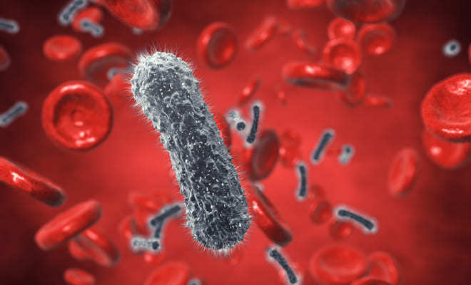 CLASIFICACION Y ETIOLOGIA
