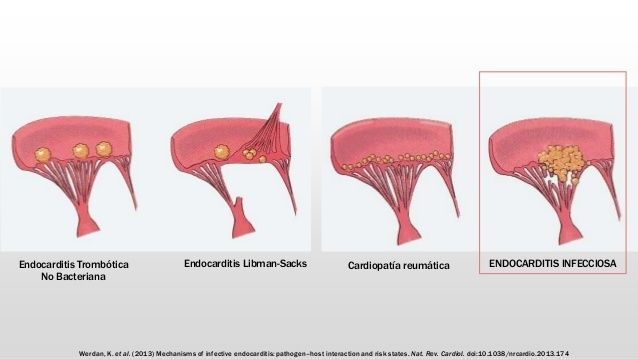 TERAPÉUTICA MEDICAMENTOSA EN ODONTOPEDIATRIA Y ENDOCARDITIS BACTERIANA