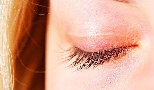 Eyelid