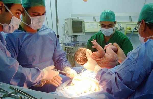 CUIDADOS DE ENFERMERÍA EN ATENCIÓN EN PARTO CESÁREA