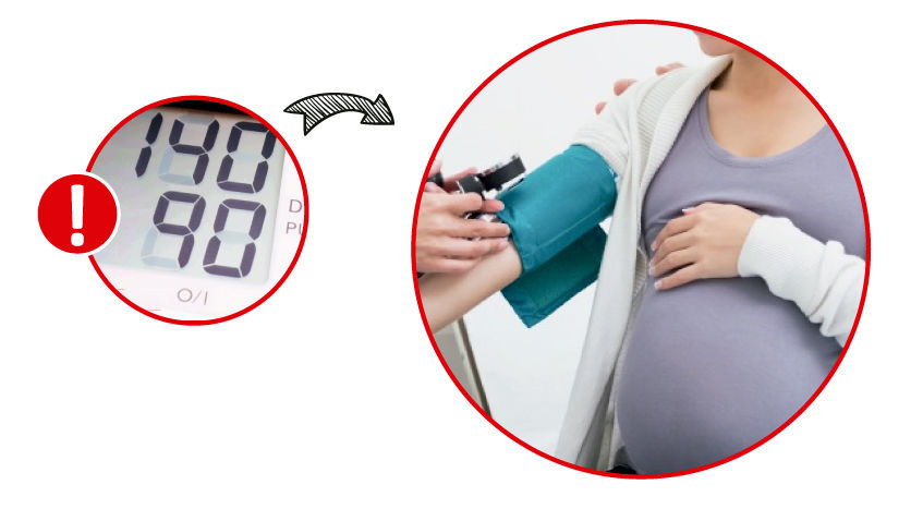 Cuidados de enfermeria en la hipertension gestacional