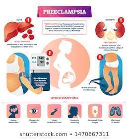 PREECLAMPSIA