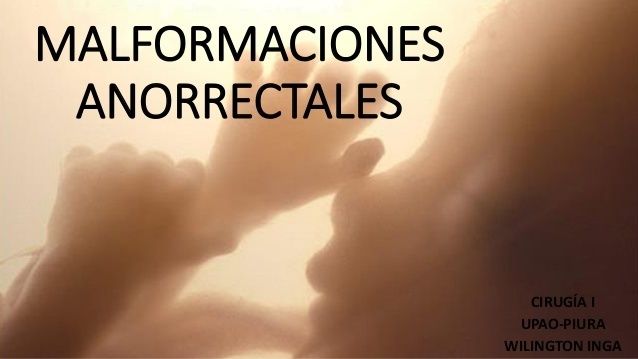 DEFINICIÓN Es la relación del recto con este complejo e incluyen grados de estenosis hasta la atresia completa INCIDENCIA De 1/3.000 naci...