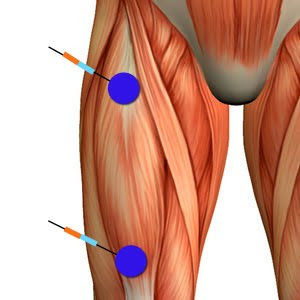 Estiramiento muscular