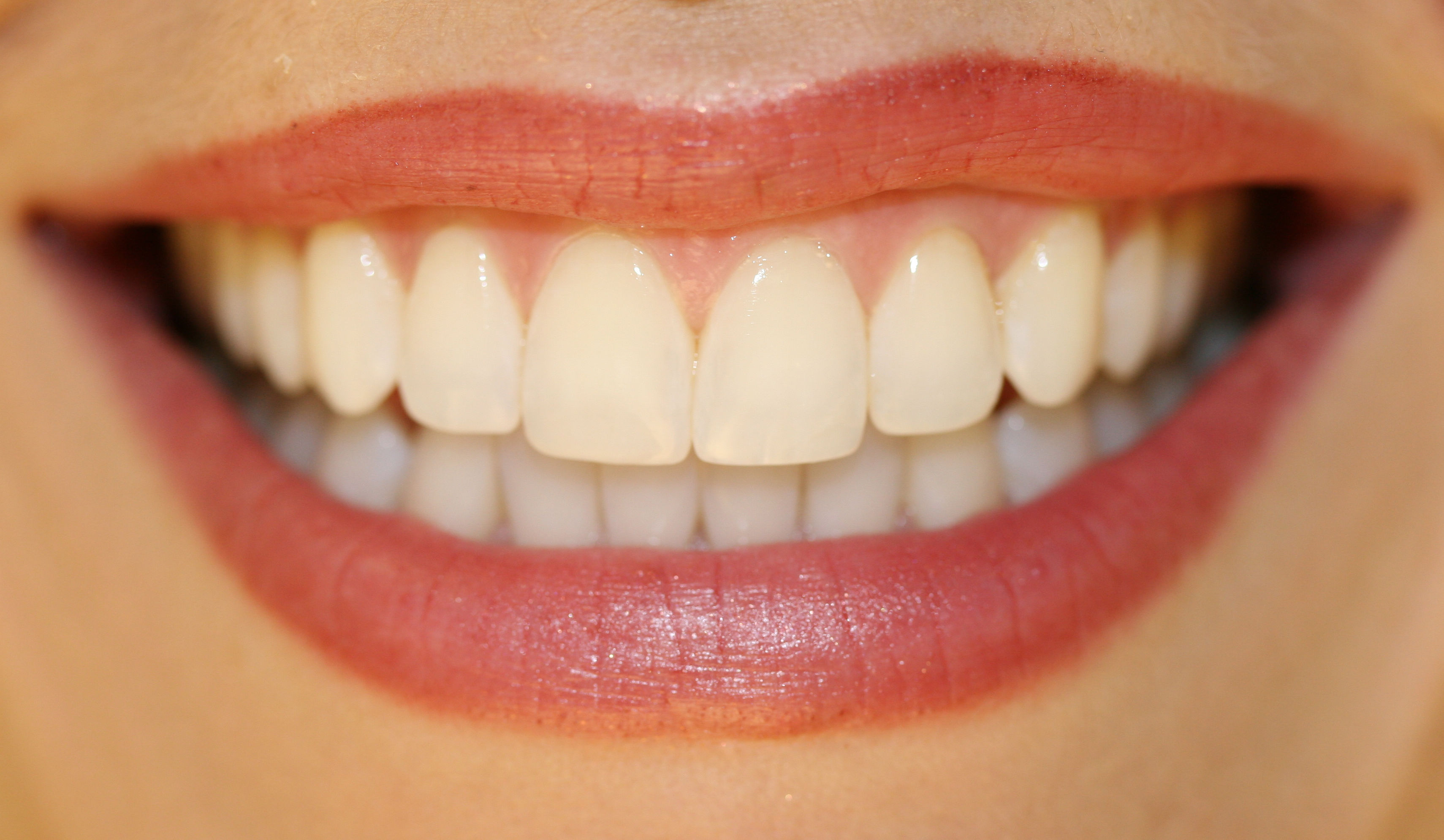 MOUTH