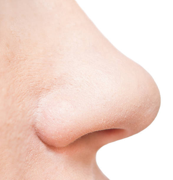 NOSE