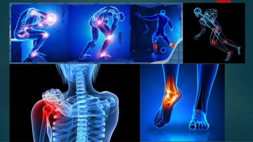 Sarcopenia: una complicación crónica en Diabetes mellitus tipo 2