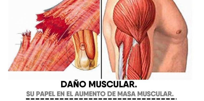 Sarcopenia: una complicación crónica en Diabetes mellitus tipo 2