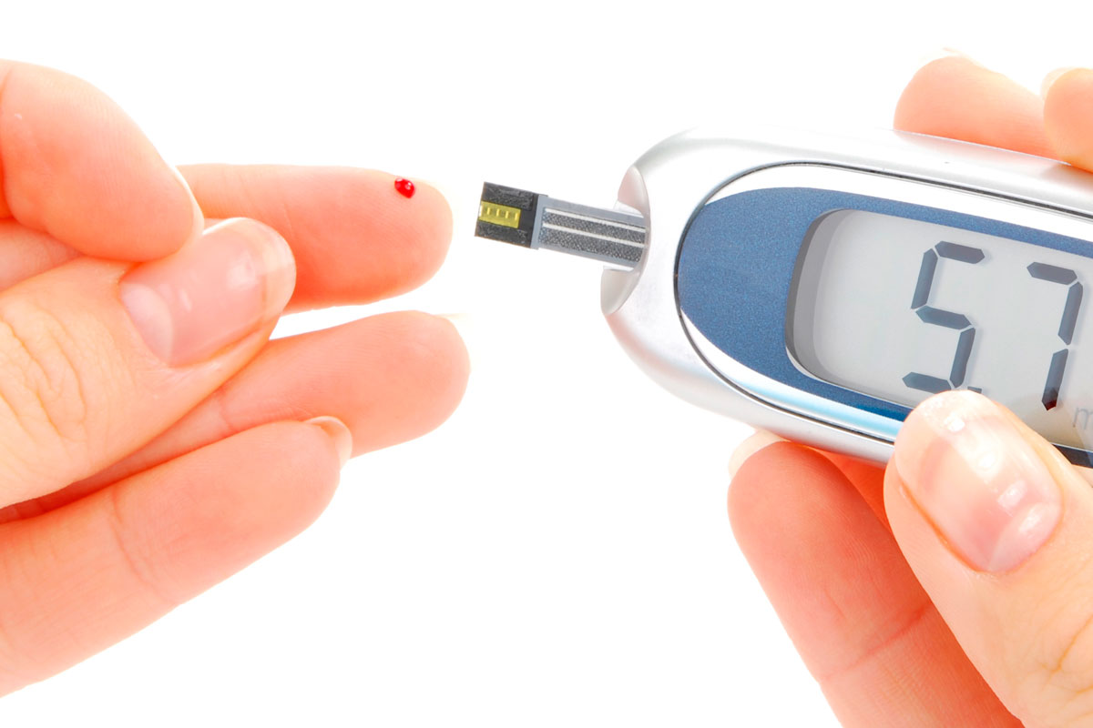 Sarcopenia: una complicación crónica en Diabetes mellitus tipo 2