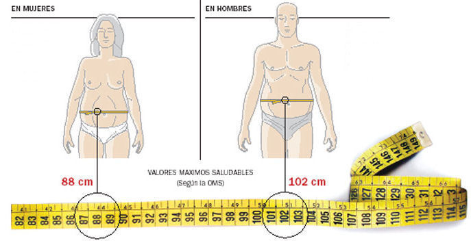 Sarcopenia: una complicación crónica en Diabetes mellitus tipo 2